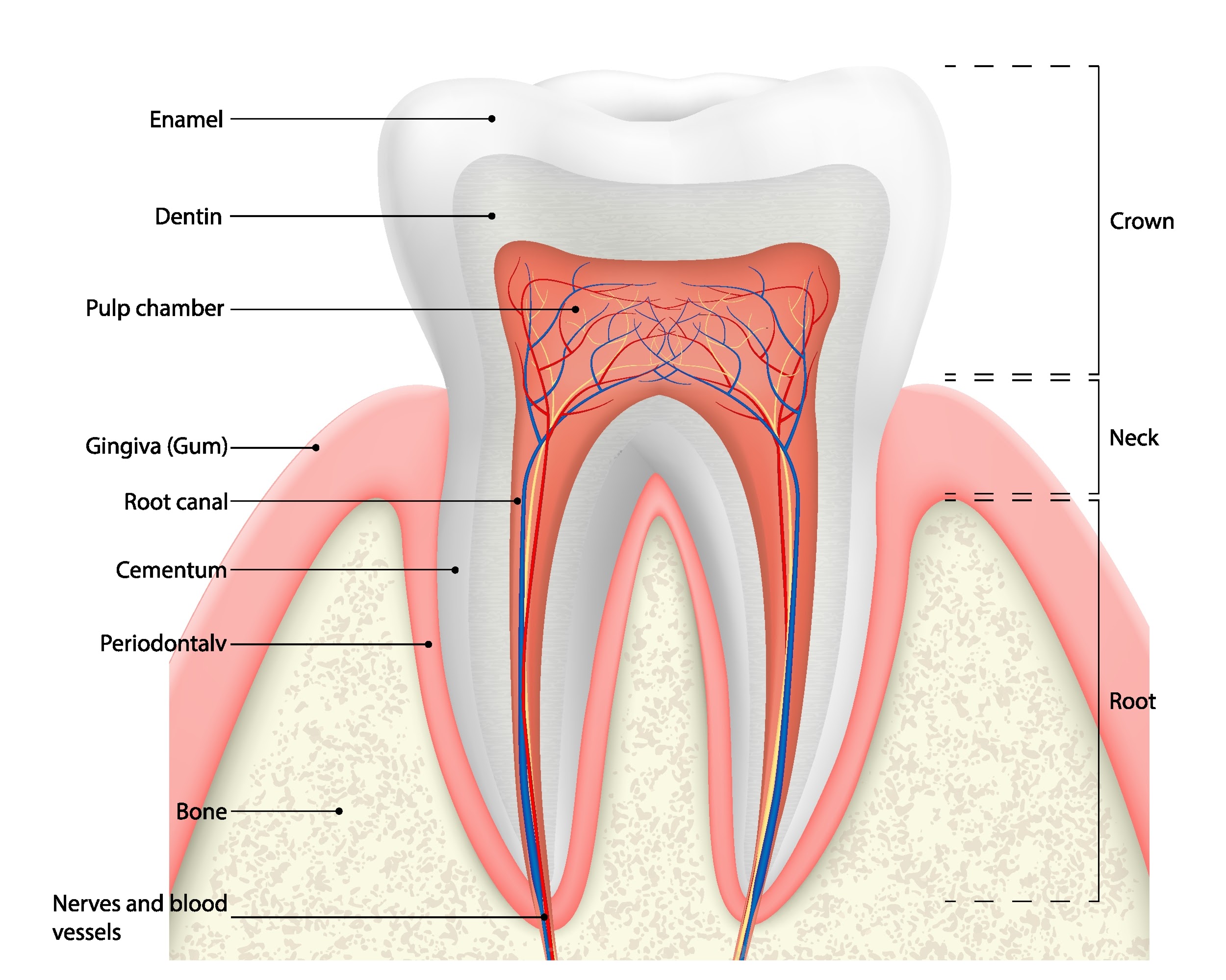 periodontitis