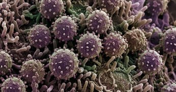 Hantavirüs Nedir? İşte bilinmesi gereken temel bilgiler