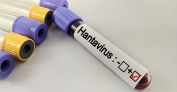 Hantavirüs Bir Salgına Dönüşür mü?