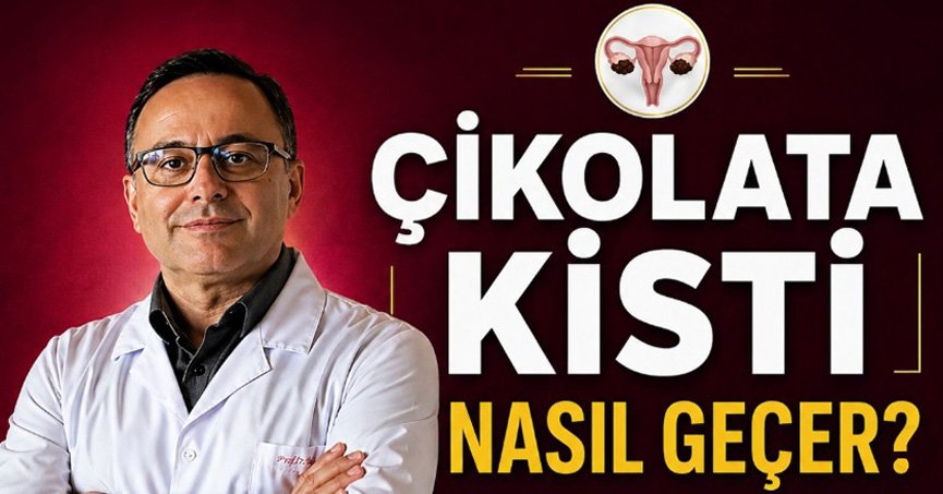 Ünlü Profesör’den kritik bilgiler: Çikolata kisti kendiliğinden geçer mi?